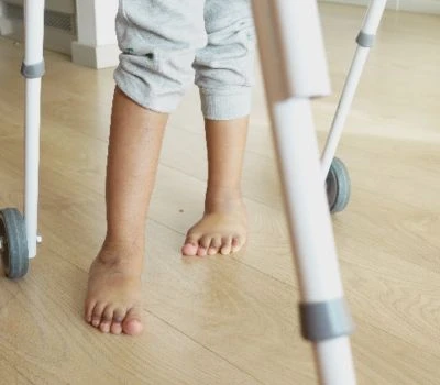 Perbedaan Panjang Kaki: Memahami Ketidakseimbangan, Mengenali Bahaya, dan Menemukan Kejelasan Den...