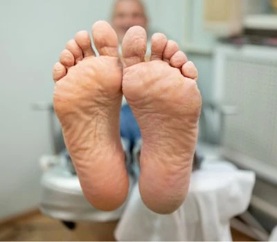 Pemeriksaan-Keruntuhan Lengkungan Terkait Usia Dan Pencegahan Jatuh Melalui Pemindaian Kaki 3D
