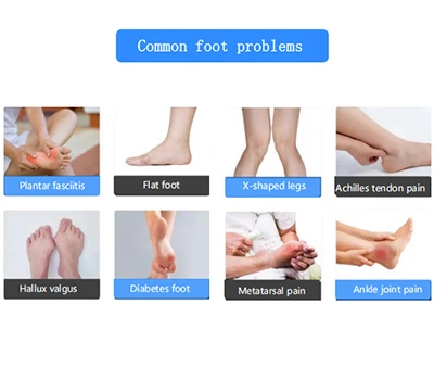 Merevolusi Perawatan Kaki: Pemindai Kaki 3D Xianku Mengubah Ortopedi dan Kesehatan Kaki