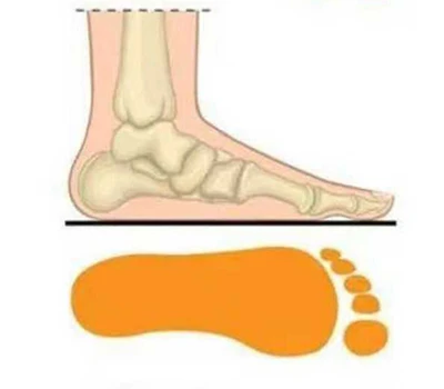 Pemutaran Kaki Datar: Cek Manual Vs. Mats Pressure Vs . 3 D AI Pemindai