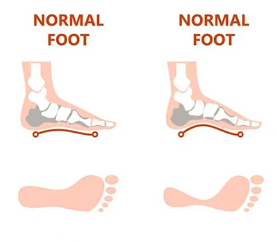 Dilema Lengkungan Tinggi: Pemeriksaan Manual Vs. Tekanan Tekanan vs . 3 D Pemindai