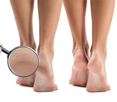 Melangkah Ke Masa Depan: Bagaimana Teknologi Pemindaian Kaki 3D Merevolusi Perawatan Podiatri